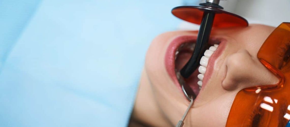 top-questions-to-ask-dentist